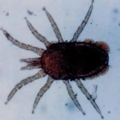 Birdmites