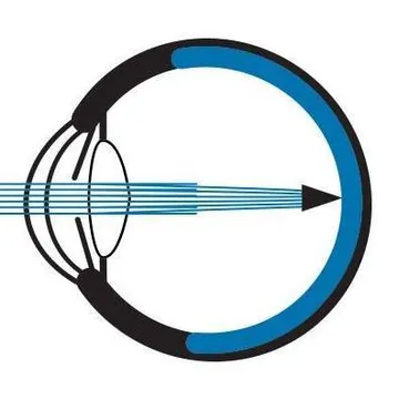 California Retina Logo