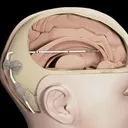 Alcyone Lifesciences logo