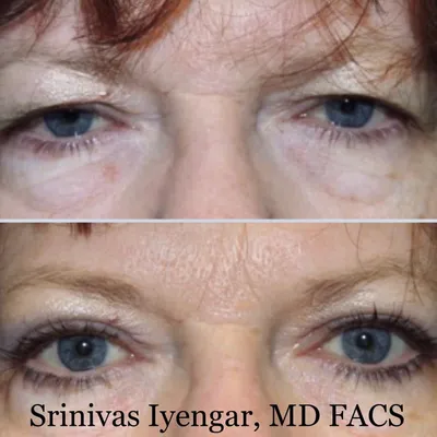 sandiegoeyelids.com's icon