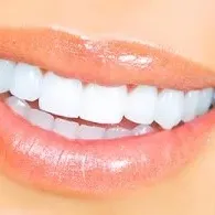 HVITE SMIL AS