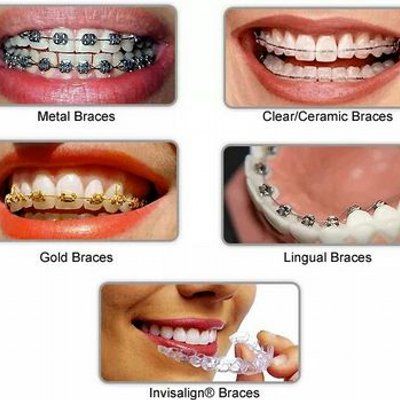 Dr.Mathesul Invisalign Orthodontist Braces Pune's icon